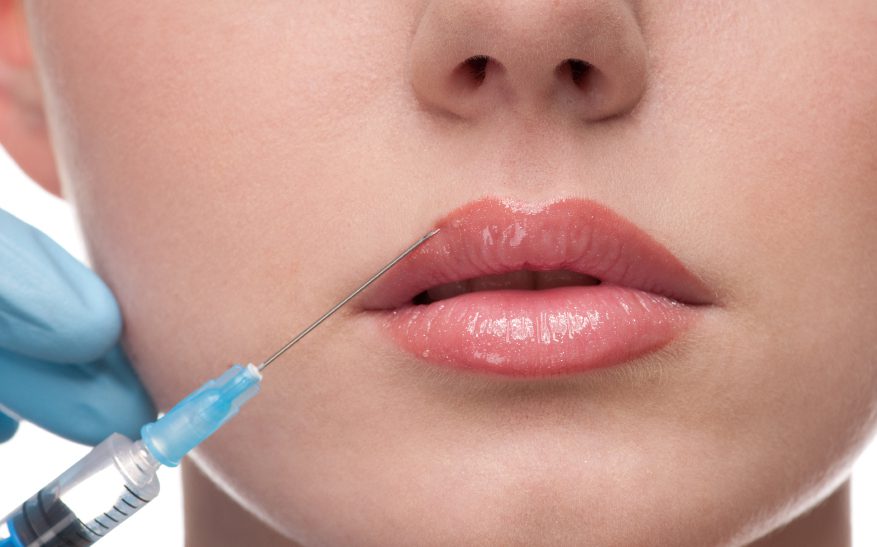 Botox – Αντιμετώπιση των ρυτίδων